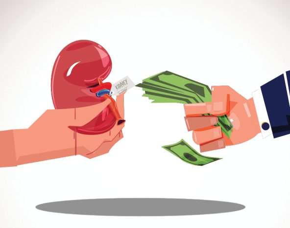 Financing your dream without selling a kidney