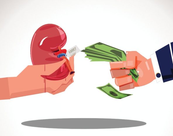 Financing your dream without selling a kidney